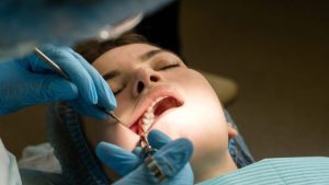 Wisdom Tooth Removal