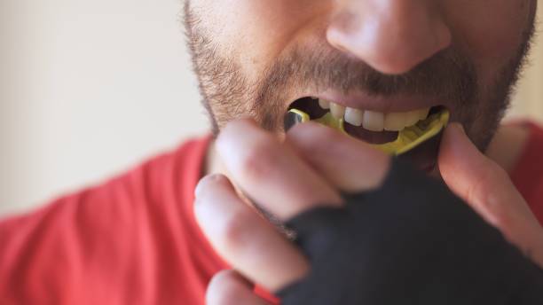 Mouthguards